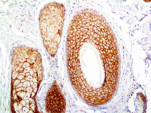 IHC of Claudin-1 on an FFPE Skin Tissue